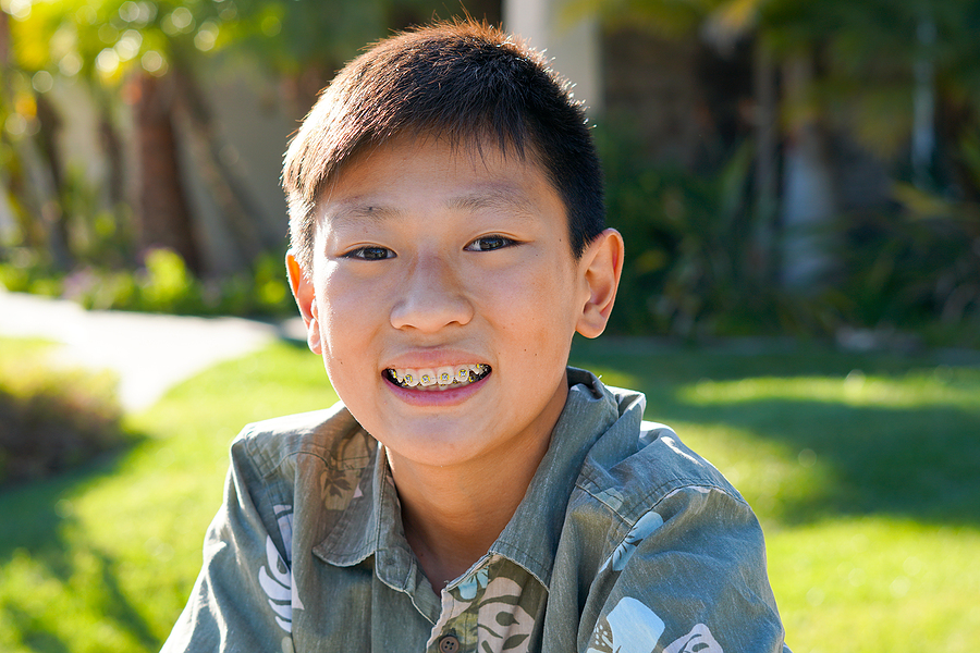 Will Wearing Braces For Student Affect Facial Shape or Structure Will Wearing Braces For Student Affect Facial Shape Or Structure