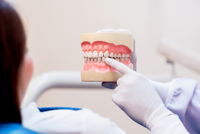 5 Things That Can Cause Stains On Your Teeth 5 Things That Can Cause Stains On Your Teeth