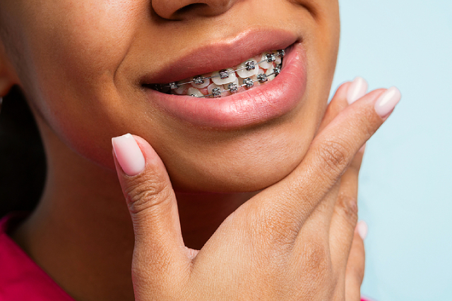 Correcting Overbites And Underbites: Treatment Options Correcting Overbites And Underbites: Treatment Options
