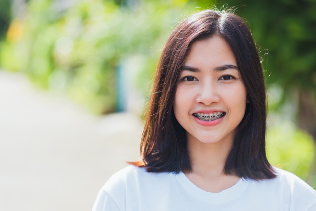 Tips For Adjusting To Life With Braces: What To Expect Tips For Adjusting To Life With Braces: What To Expect