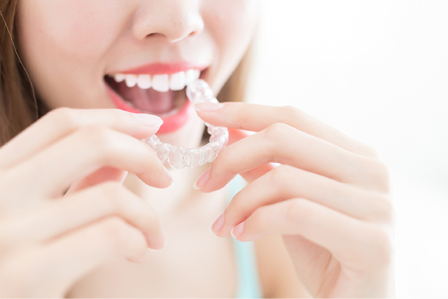 5 Must-Have Accessories When Getting Invisalign Treatment 5 Must-Have Accessories When Getting Invisalign Treatment
