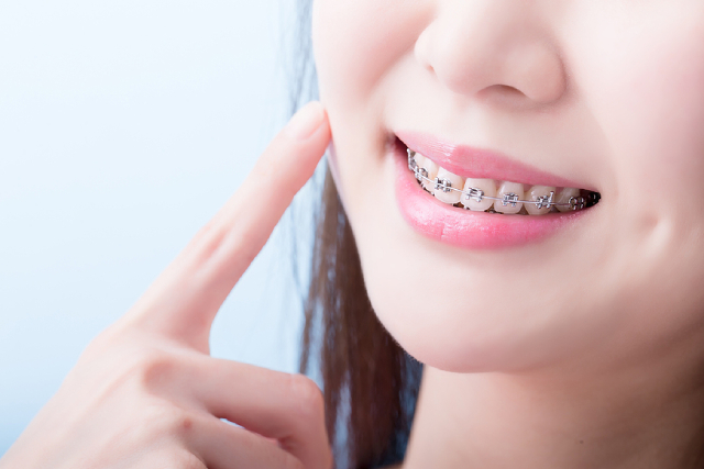 How To Choose Between Invisible Braces & Traditional Braces How To Choose Between Invisible Braces & Traditional Braces
