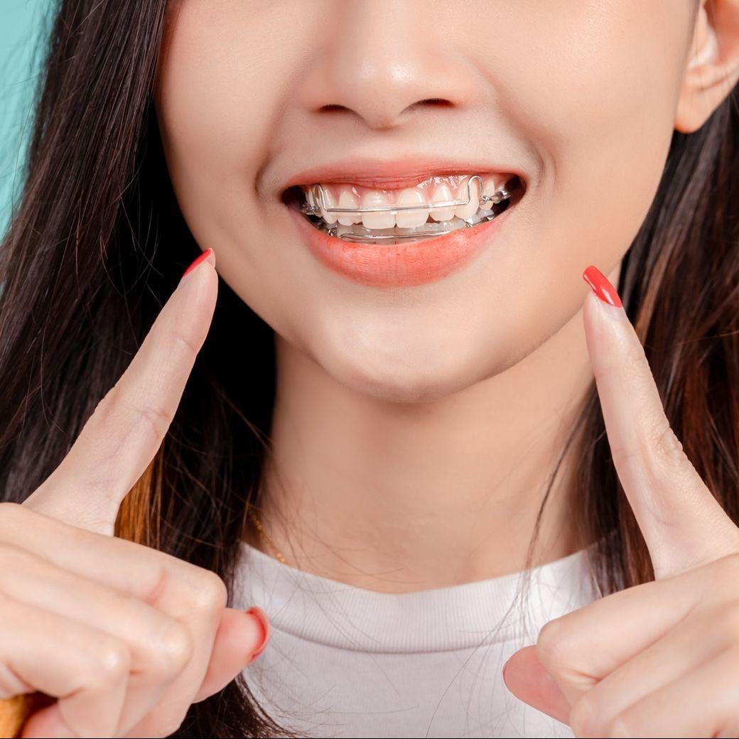 overcoming-braces-anxiety Overcoming Braces Anxiety