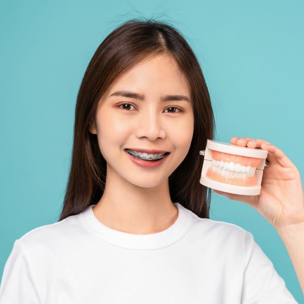 Braces For Student in Singapore - The Benefits and Cost Braces For Student in Singapore - The Benefits and Cost