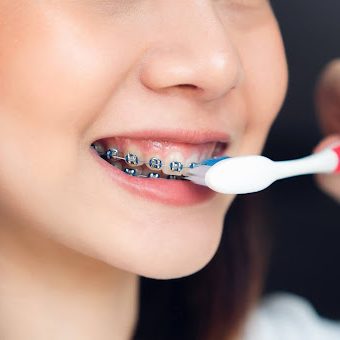 Pick the Right Toothbrush for Braces